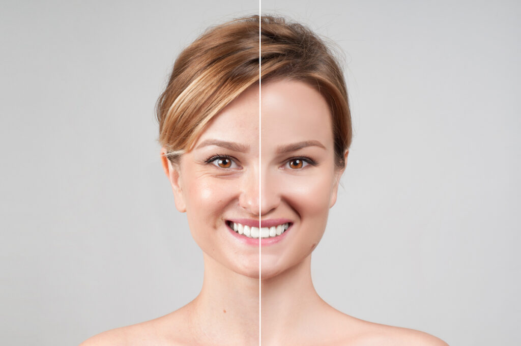 before after image