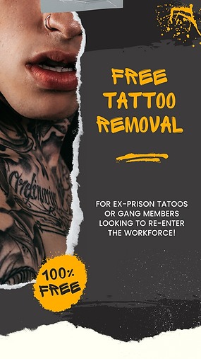 Free Tattoo Removal for ex-prisoners or ex gang members